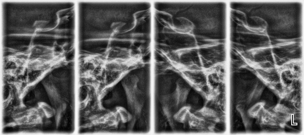 Темпоромандибуларни стави
